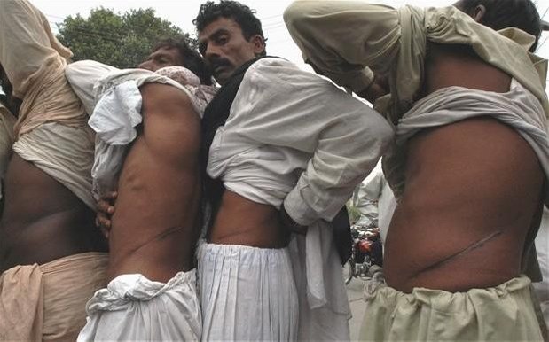 Organ Trafficking In Pakistan